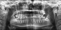 Chirurgia orale e implantologia